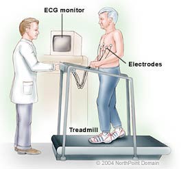 ekg-stress-2